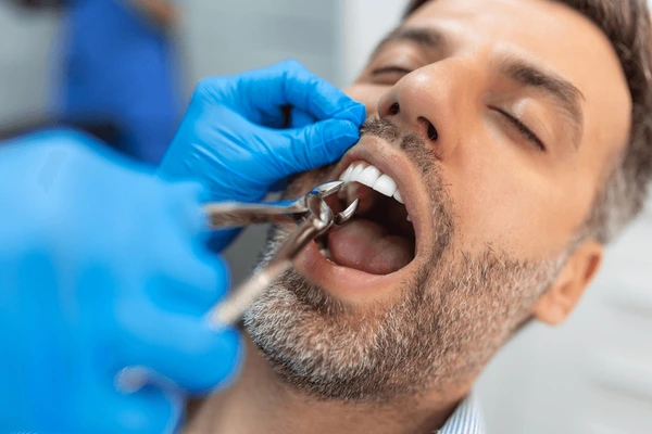 Chirurgie dentaire Rabat
